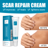 West&Month Skin Repair Cream Gentle Moisturizing Hydrating Moisturizing Repair Skin Care Repair Cream
