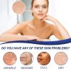 Hoygi Collagen & Retinol Cream Lighten Fine Lines, Firming Skin And Moisturizing Moisturizing Cream