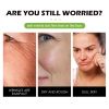 Hoygi Retinol Face Cream Firming And Lifting Facial Skin Reduces Fine Lines And Wrinkles, Hydrating And Anti-Wrinkle Cream